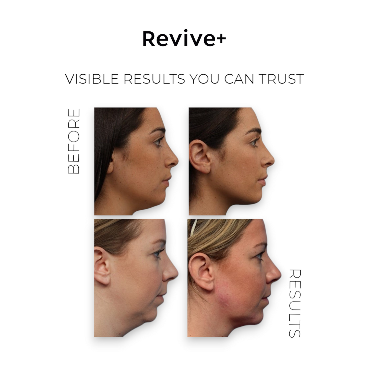 V-Lift Sculpt Pro™