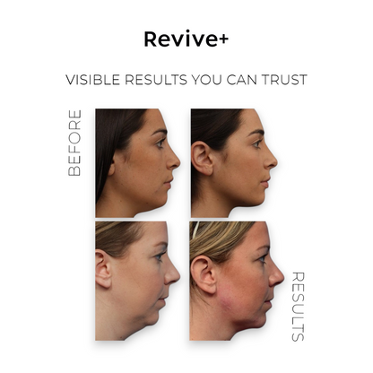 V-Lift Sculpt Pro™