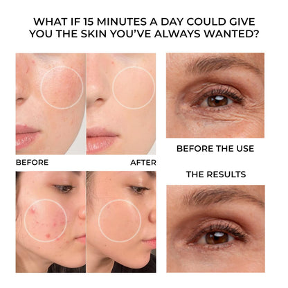 FaceGlow+™ Ultra Light Therapy Mask