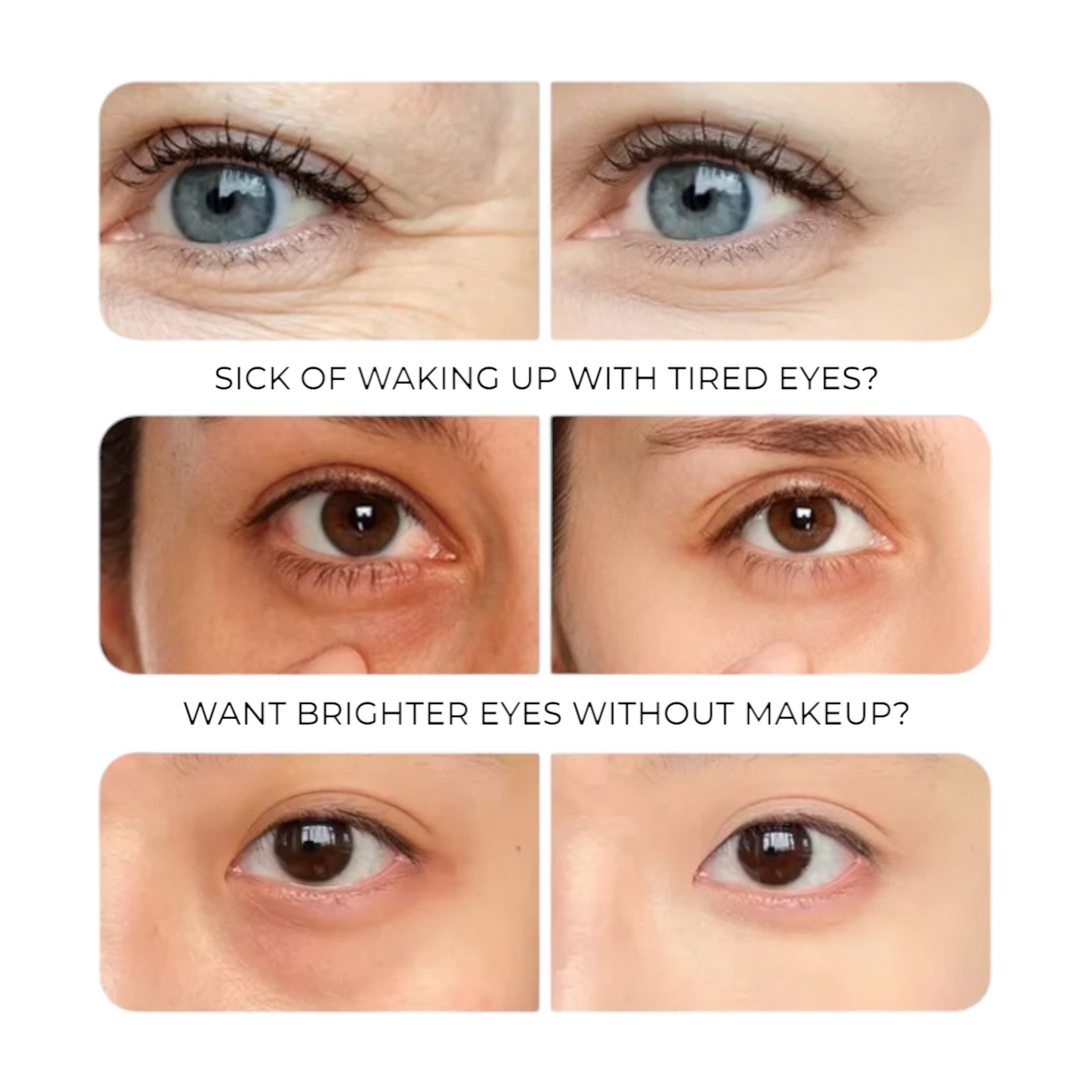 ReviveEyes™ Dark Circles Remover