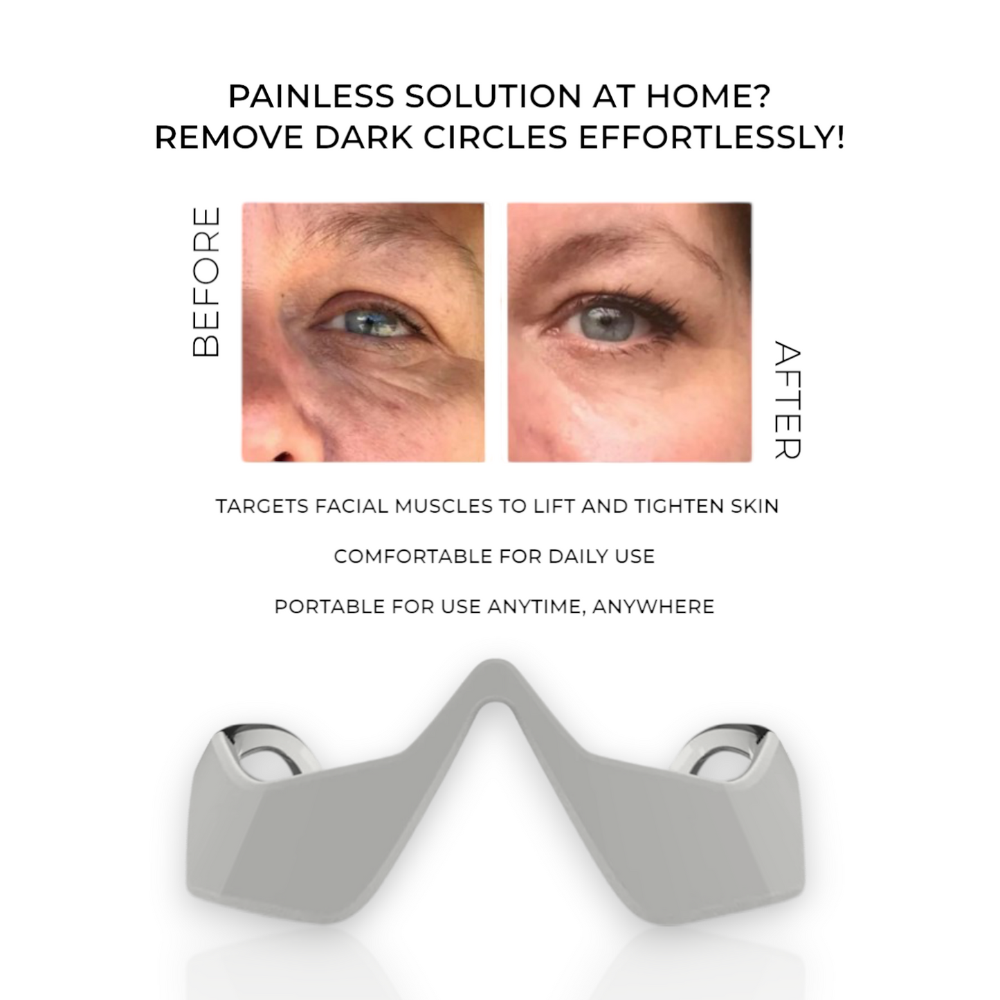ReviveEyes™ Dark Circles Remover
