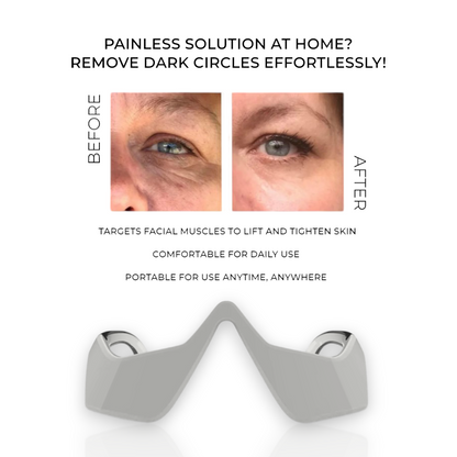 ReviveEyes™ Dark Circles Remover